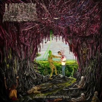 Undeath - Lesions Of A Different Kind - LP